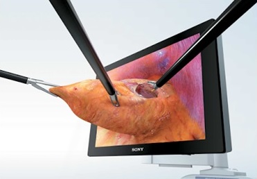 3D+4K腹腔鏡手術系統