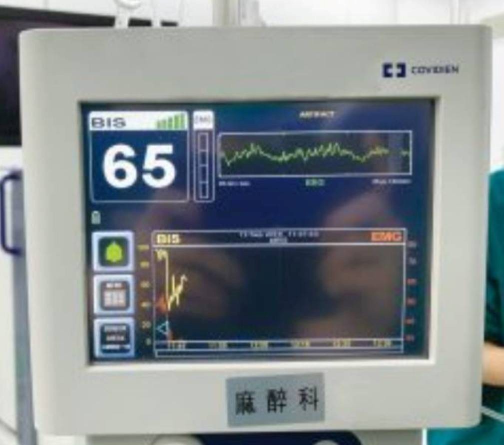 BIS monitor (Bispectral Index monitor)