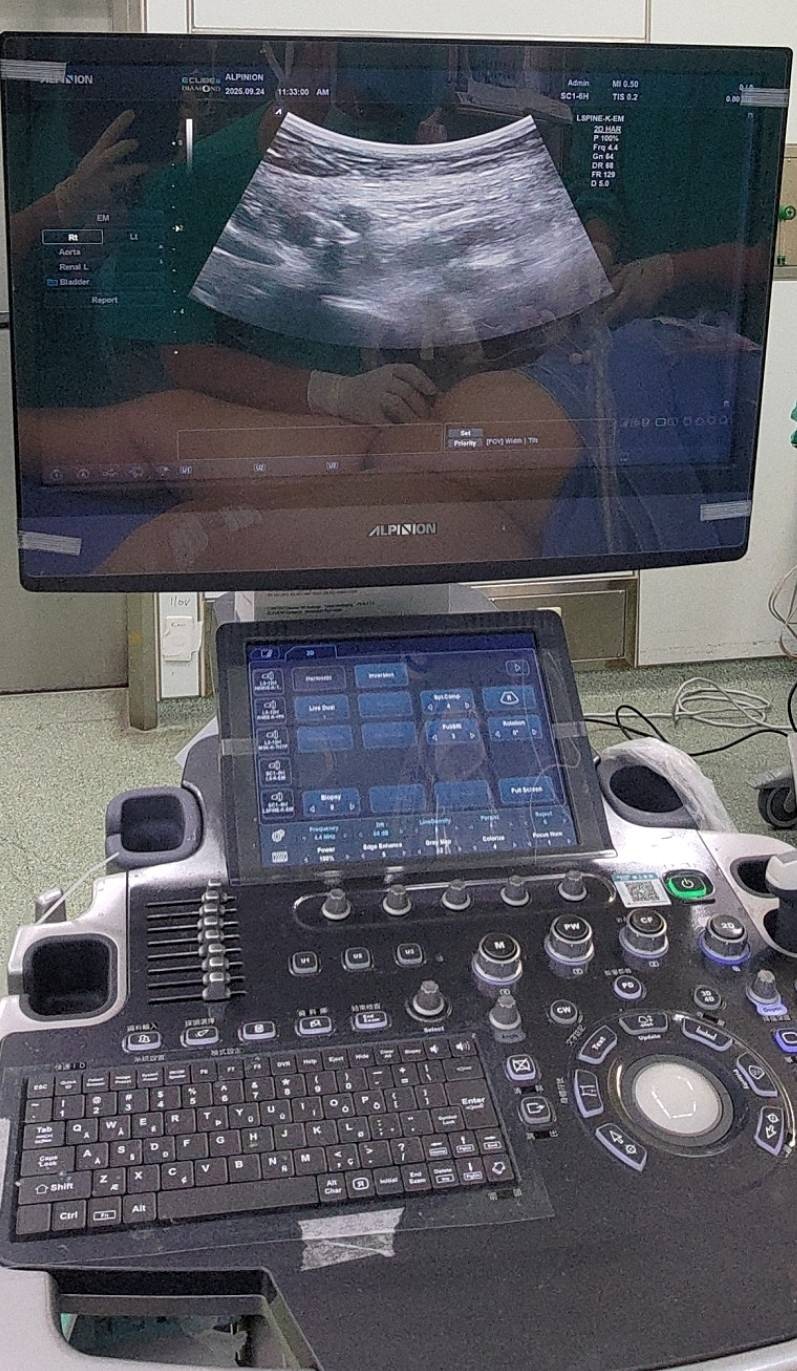 Ultrasound imaging assistance equipment