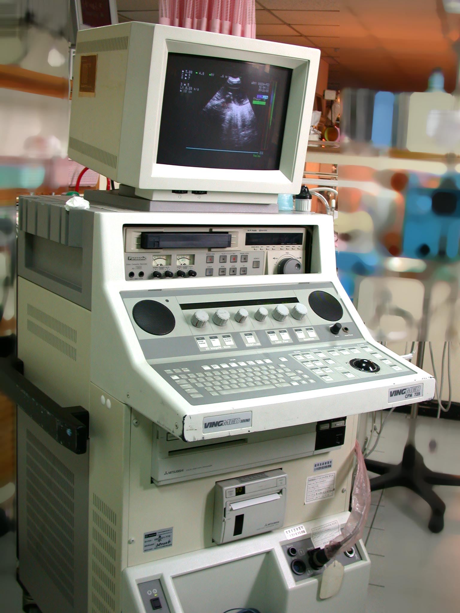 Color Doppler Echocardiogram