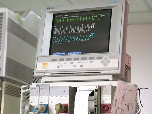 Cardiopulmonary Monitor