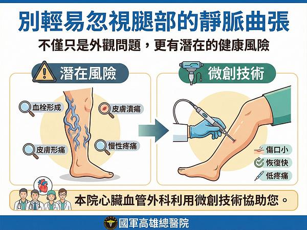 足にミミズ？美脚を取り戻し、浮足筋の悩みを解消！